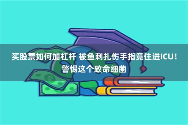 买股票如何加杠杆 被鱼刺扎伤手指竟住进ICU！警惕这个致命细菌